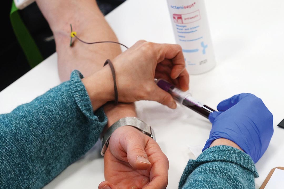 Blutabnahme, um die Auswirkungen des Cannabis-Konsums zu dokumentieren